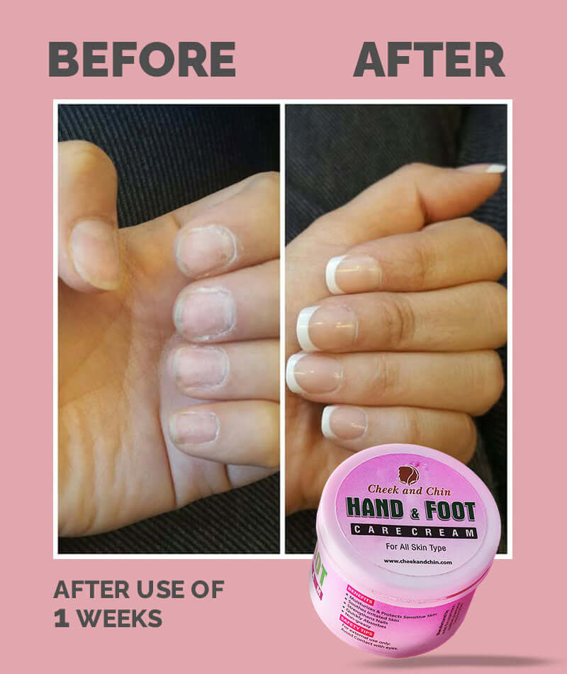 Hand & Foot  Whitening Cream – Deep Moisture & Repair | Special offer Buy 1 get 1 free.